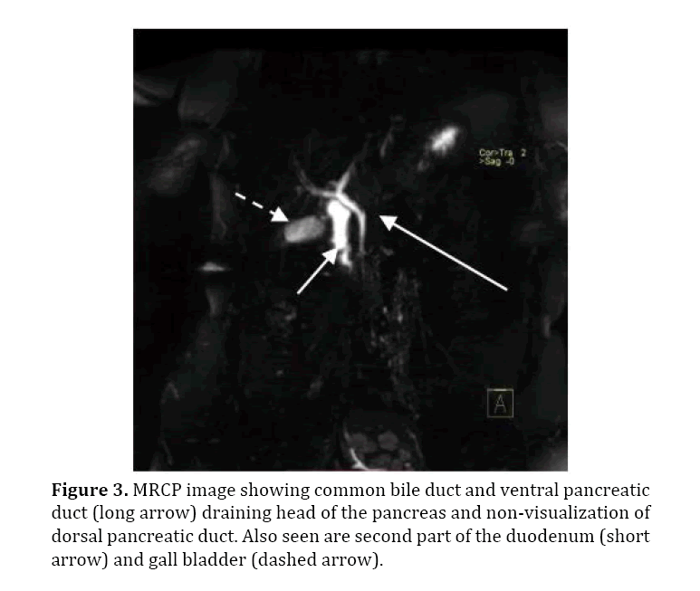 pancreas-duct-ventral-pancreatic