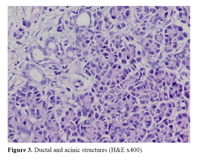 pancreas-ductal-acinic-structures