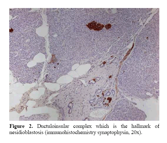 pancreas-ductuloinsular-complex