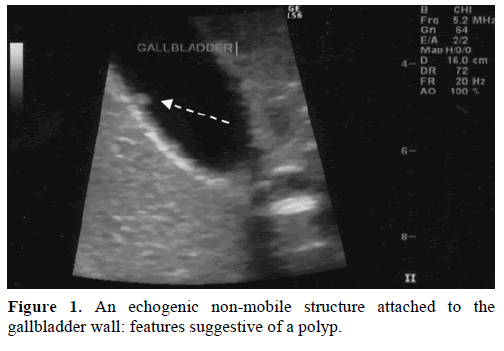 pancreas-echogenic-non-mobile-structure