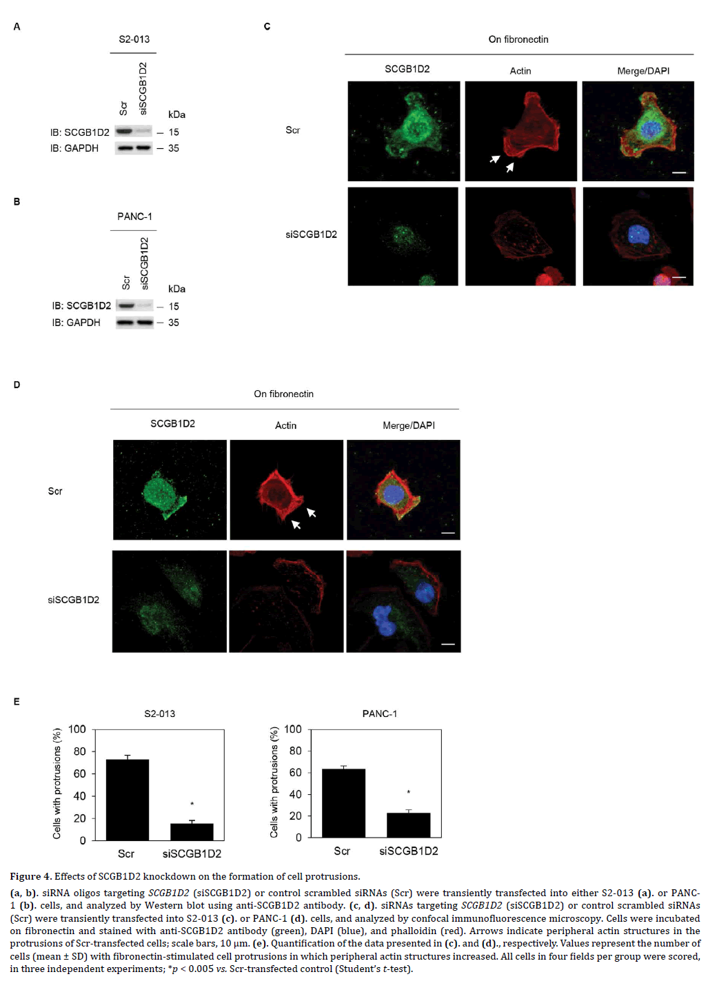 pancreas-effects-scgb1d2-knockdown