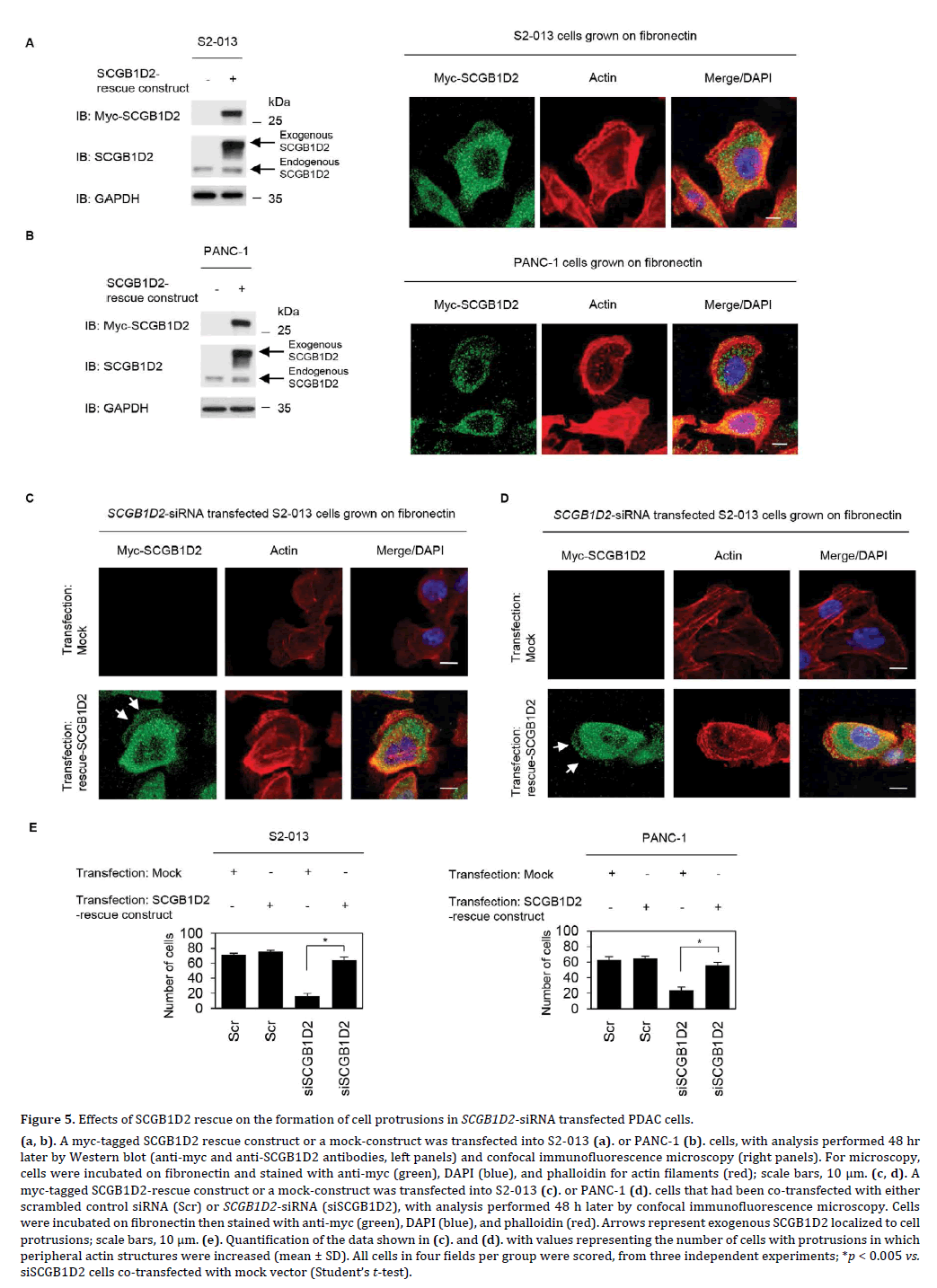 pancreas-effects-scgb1d2-rescue