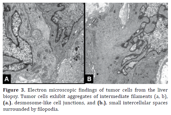 pancreas-electron-microscopic-findings