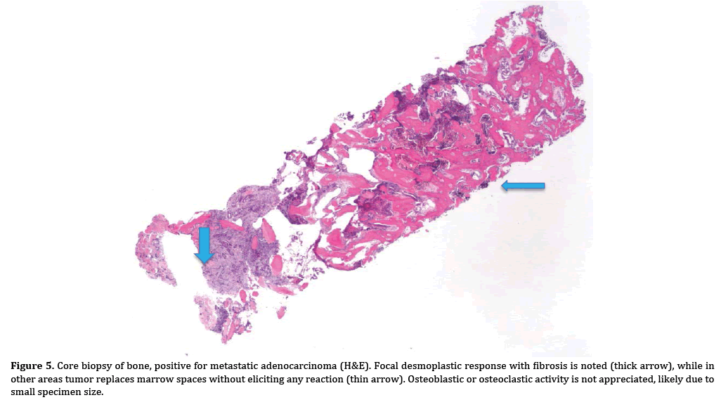 pancreas-eliciting