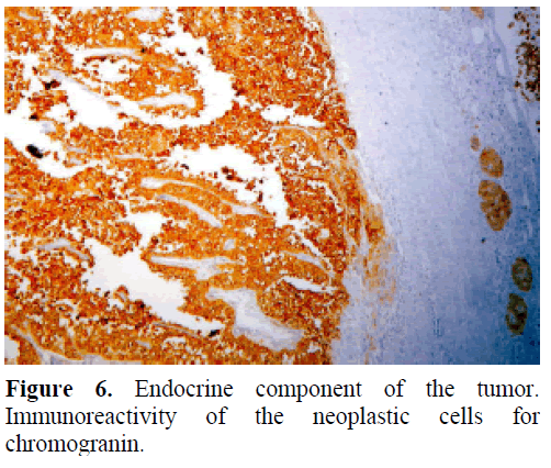 pancreas-endocrine-component-chromogranin