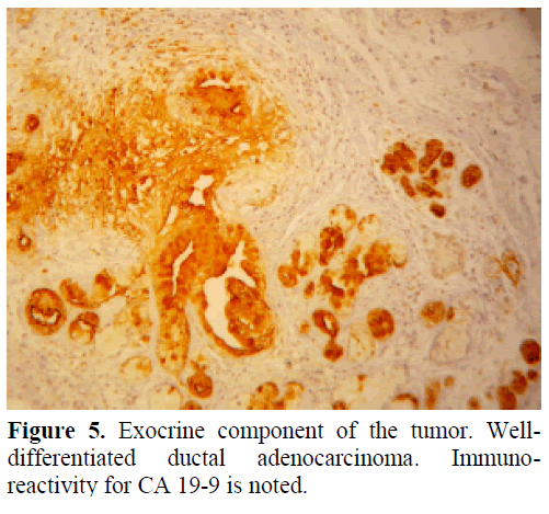 pancreas-endocrine-component-ductal