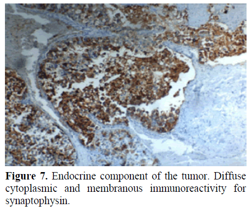 pancreas-endocrine-component-synaptophysin