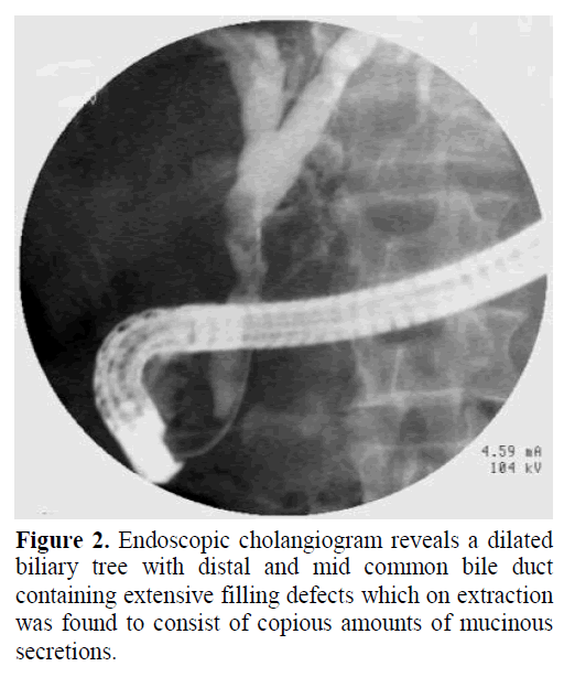 pancreas-endoscopic-cholangiogram