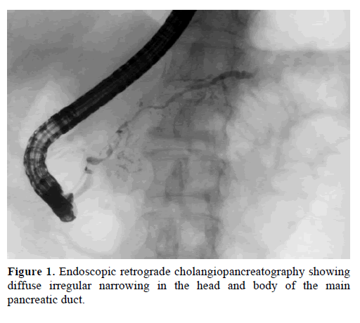 pancreas-endoscopic-cholangiopancreatography