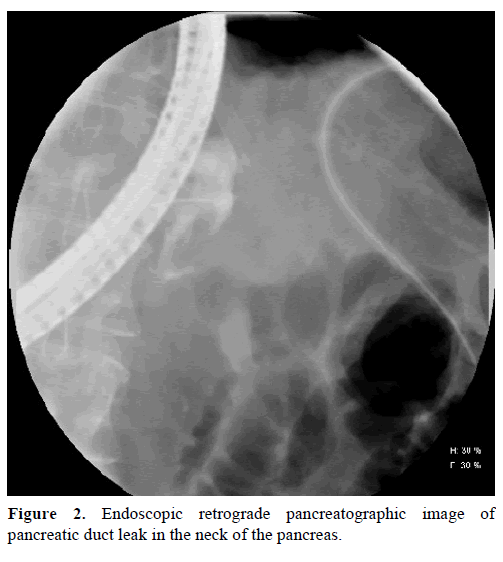 pancreas-endoscopic-retrograde-image