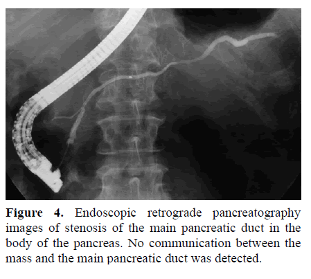 pancreas-endoscopic-retrograde-pancreatography
