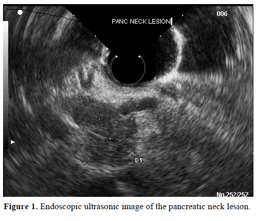 pancreas-endoscopic-ultrasonic-image