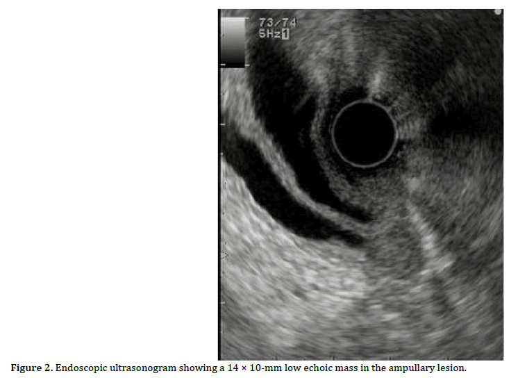 pancreas-endoscopic-ultrasonogram