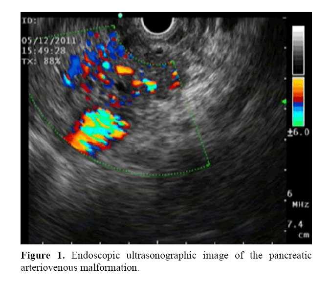 pancreas-endoscopic-ultrasonographic