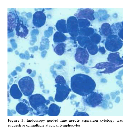 pancreas-endoscopy-guided-fine