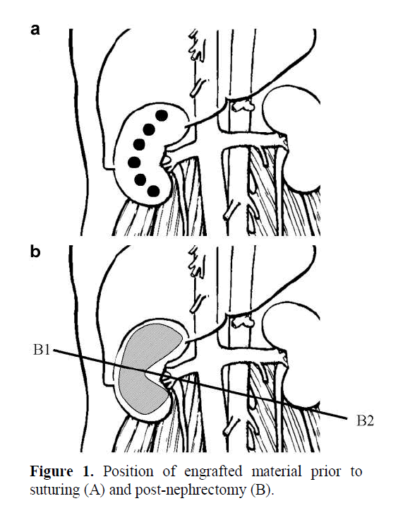 pancreas-engrafted-material-prior