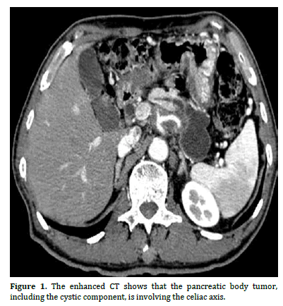 pancreas-enhanced