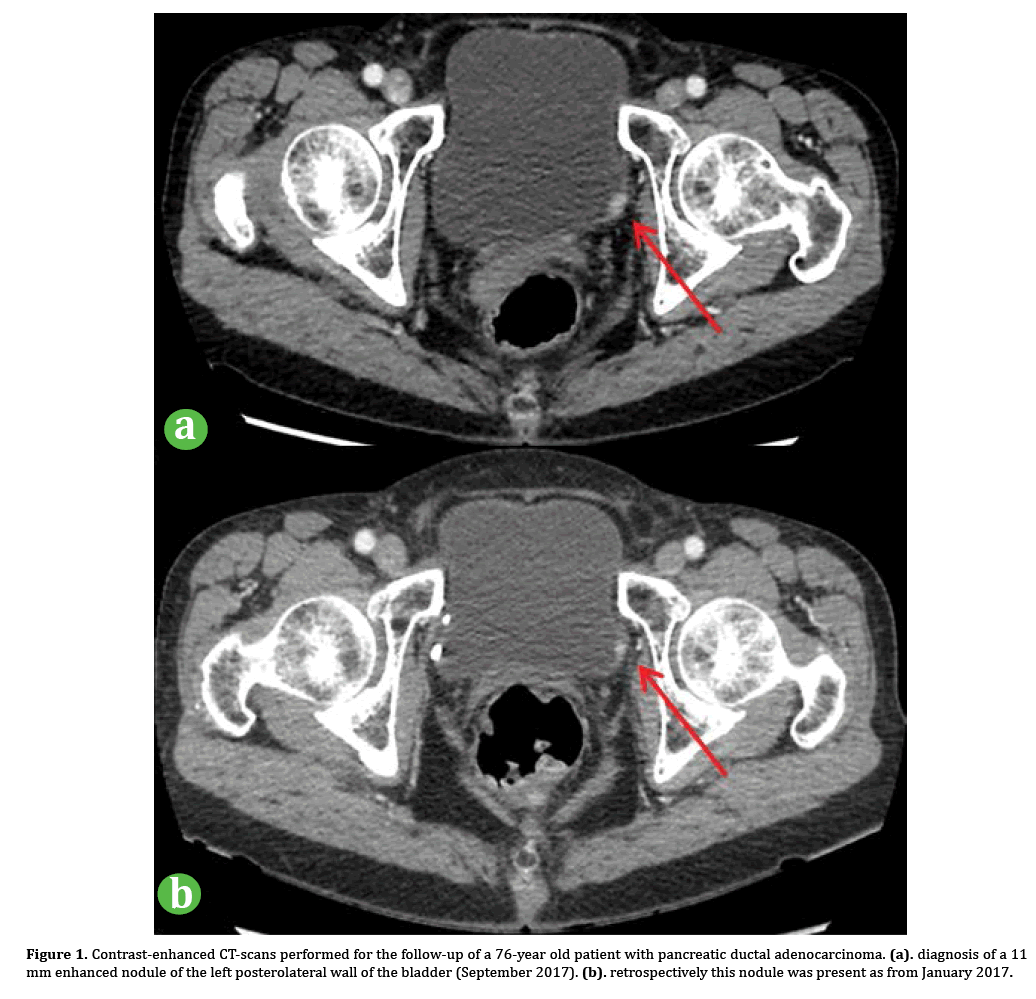 pancreas-enhanced