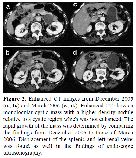 pancreas-enhanced-ct-images-monolocular