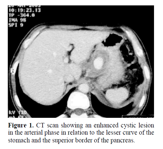 pancreas-enhanced-cystic-lesion