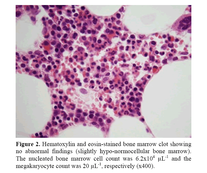 pancreas-eosin-stained-bone-marrow