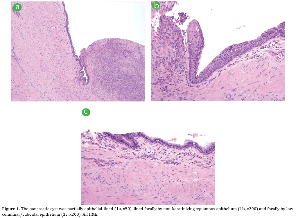 pancreas-epithelial-lined