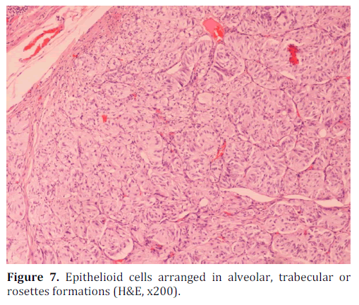 pancreas-epithelioid-cells-alveolar