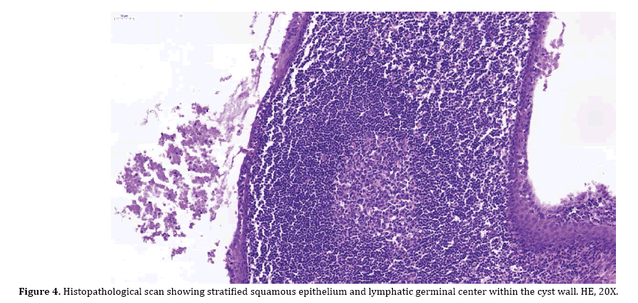 pancreas-epithelium