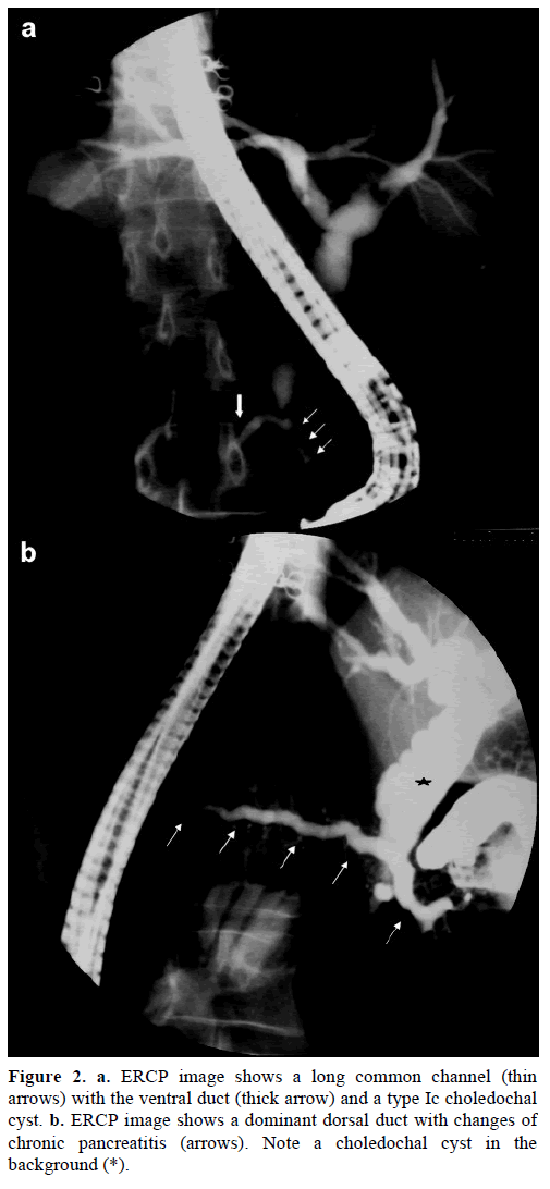 pancreas-ercp-image-common-channel