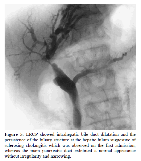 pancreas-ercp-intrahepatic-bile-duct