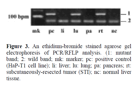 pancreas-ethidium-bromide-stained