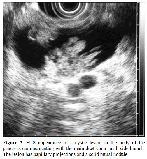 pancreas-eus-appearance-cystic-lesion