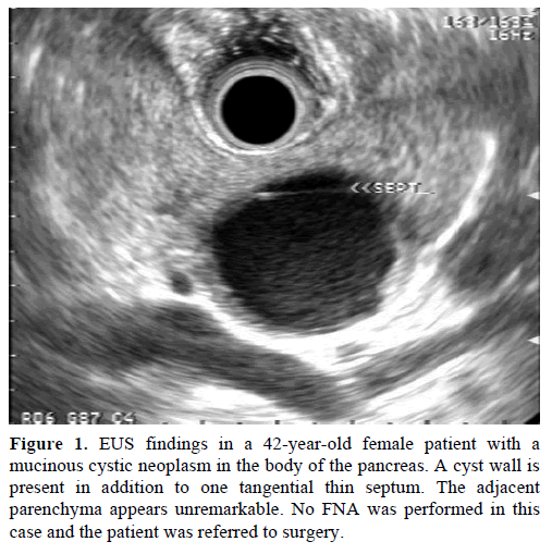 pancreas-eus-findings-42-year-old