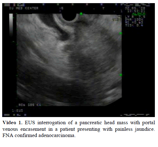 pancreas-eus-interrogation-pancreatic