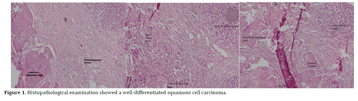 pancreas-examination