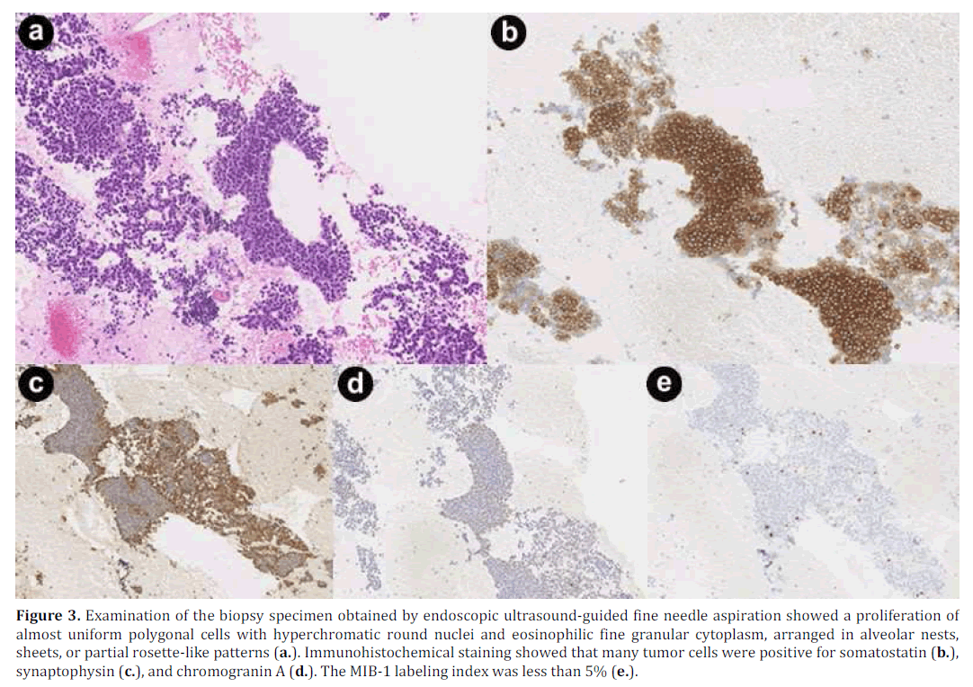 pancreas-examination-specimen