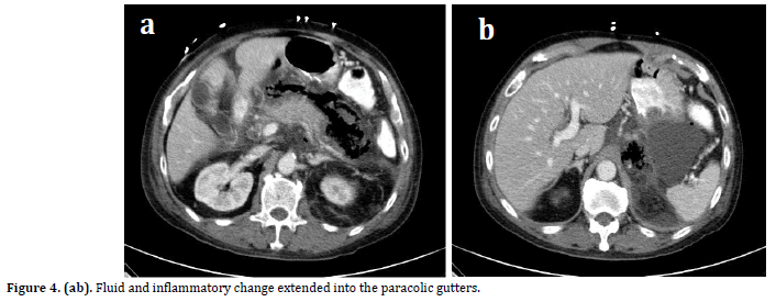 pancreas-extended