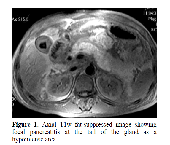 pancreas-fat-suppressed-image