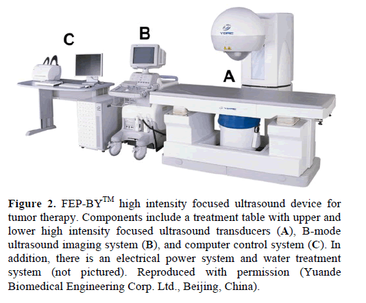 pancreas-fep-by-ultrasound-device-tumor