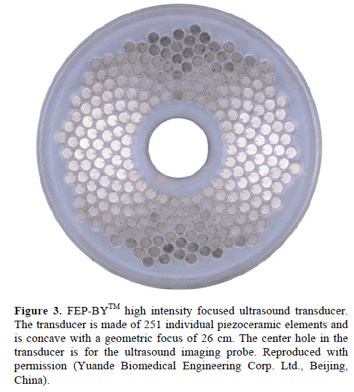 pancreas-fep-by-ultrasound-transducer