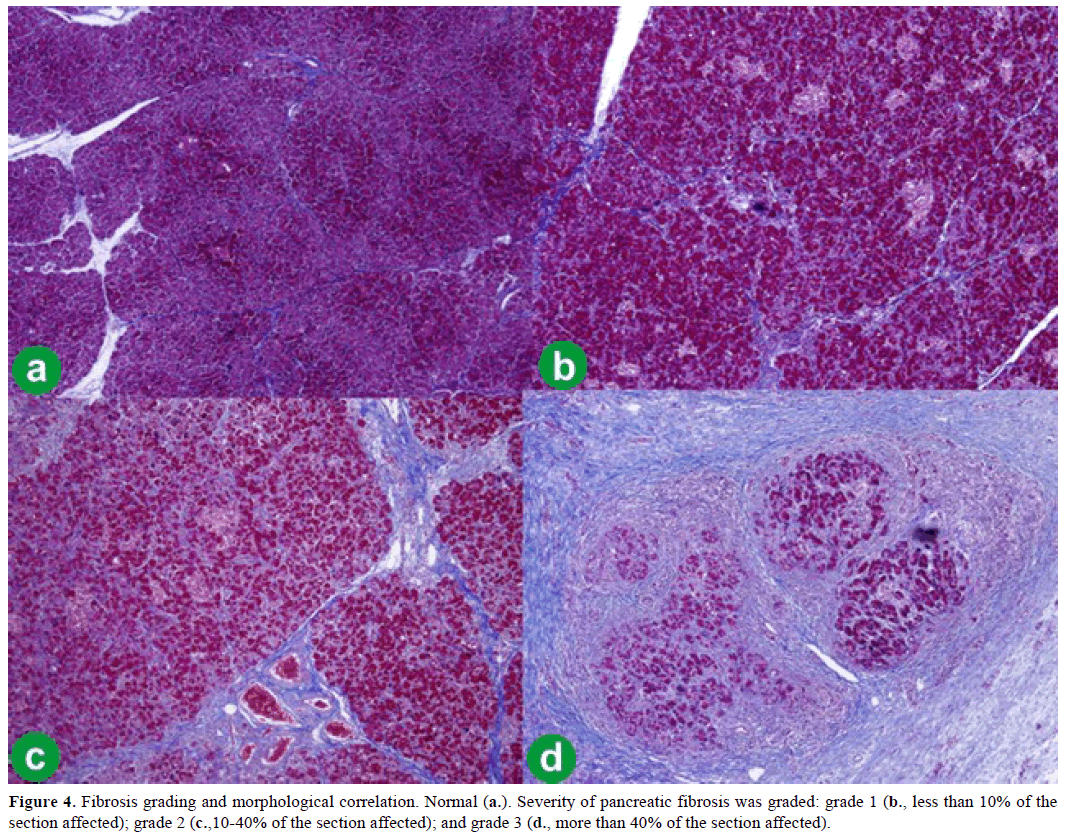 pancreas-fibrosis-grading-morphological