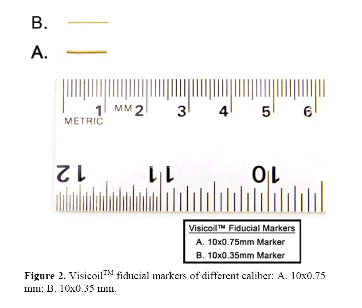 pancreas-fiducial-markers-different