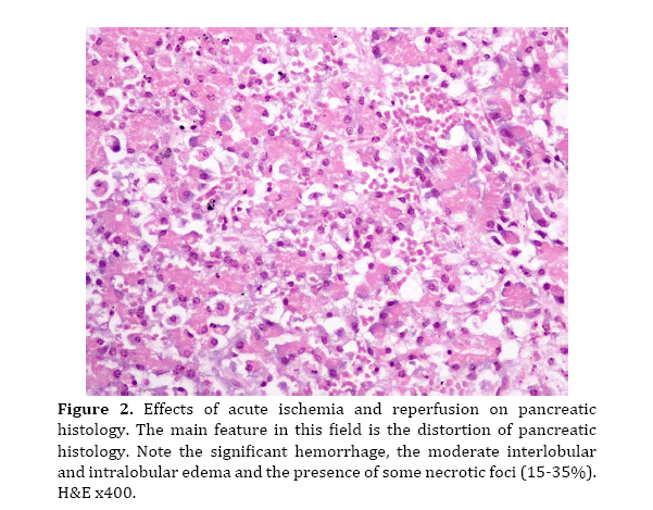 pancreas-field-distortion-pancreatic