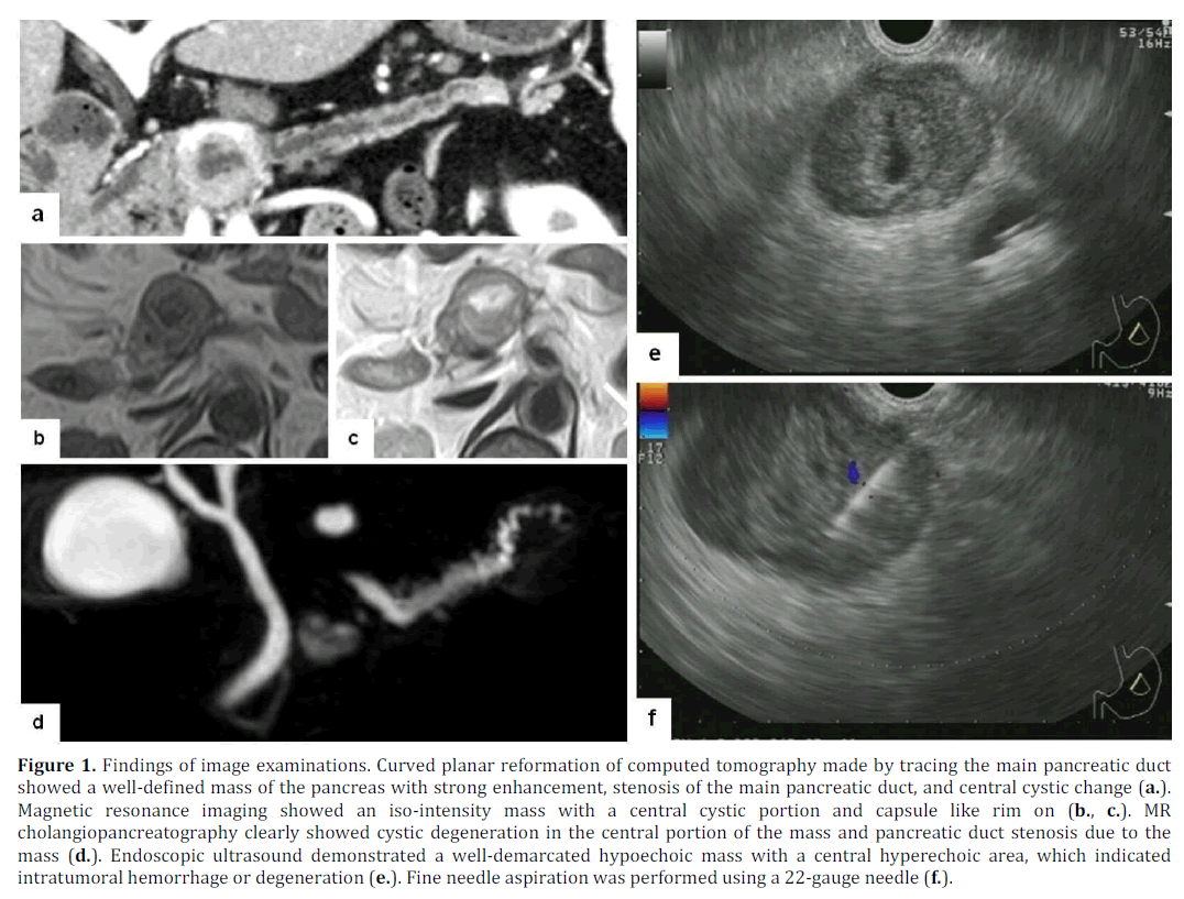 pancreas-findings-image-examinations