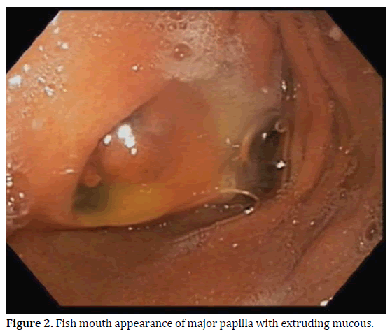 pancreas-fish-mouth-appearance-papilla