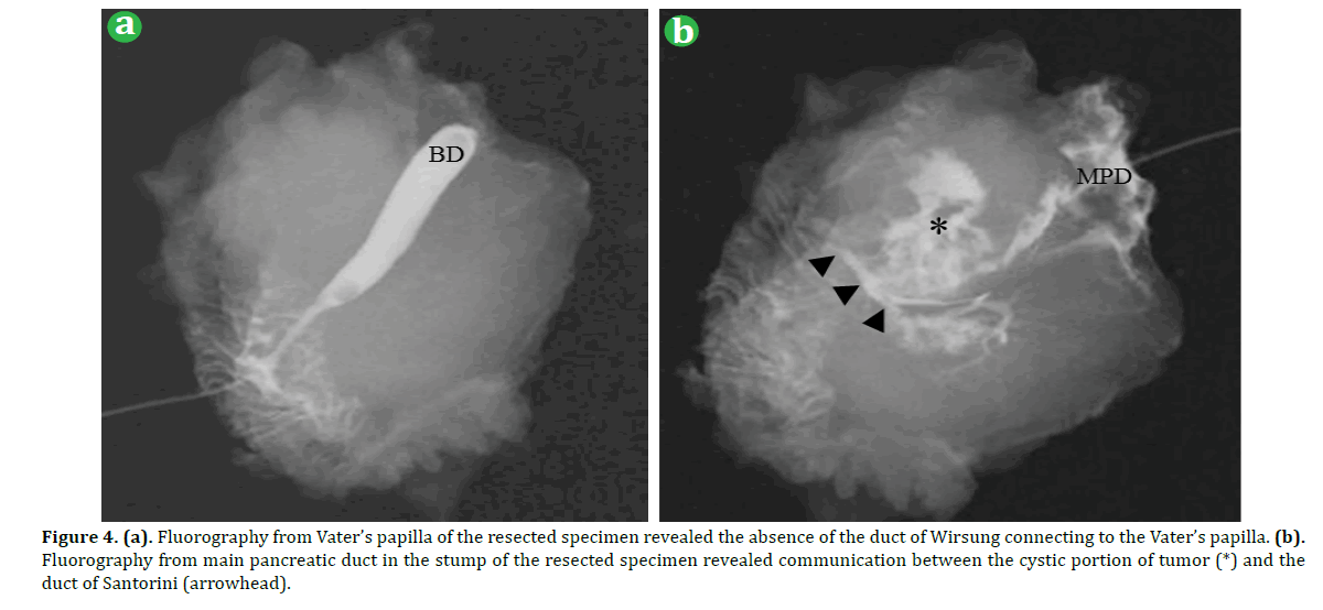 pancreas-fluorography-Vater-papilla