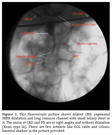 pancreas-fluoroscopic