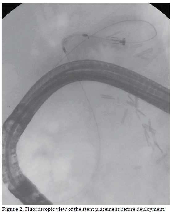 pancreas-fluoroscopic-view