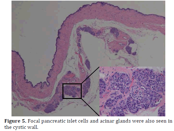 pancreas-focal-pancreatic-islet-cells