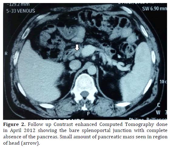 pancreas-follow-contrast-enhanced